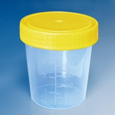Urinbecher 125 ml, komplett aufmontiert mit gelbem Schraubdeckel, einzeln steril