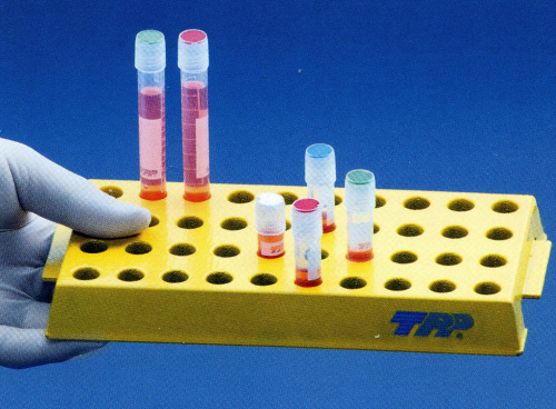 arbeitsrack_gelb_tpp_40_plaetz arbeitsrack_gelb_tpp_40_plaetz