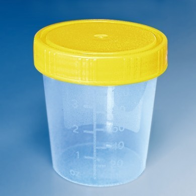 urinbecher_125_ml_komplett_auf