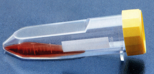 zellkulturflachroehrchen_mit_f